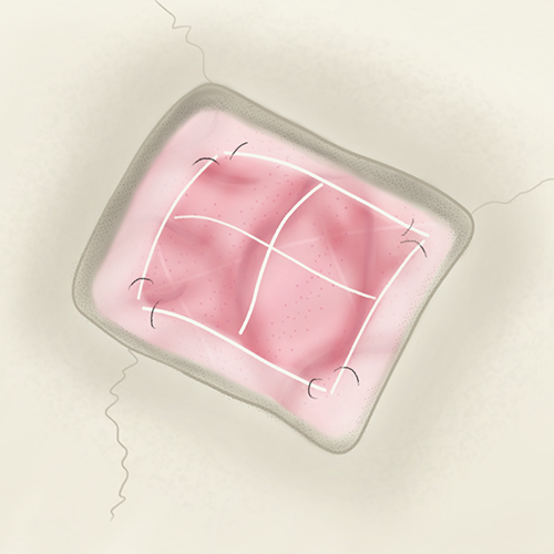 Img MEC DuraSoft Premium